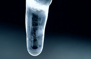 Ice Reigns Terror on Sensitive Teeth Sufferers in This Sensodyne Ad