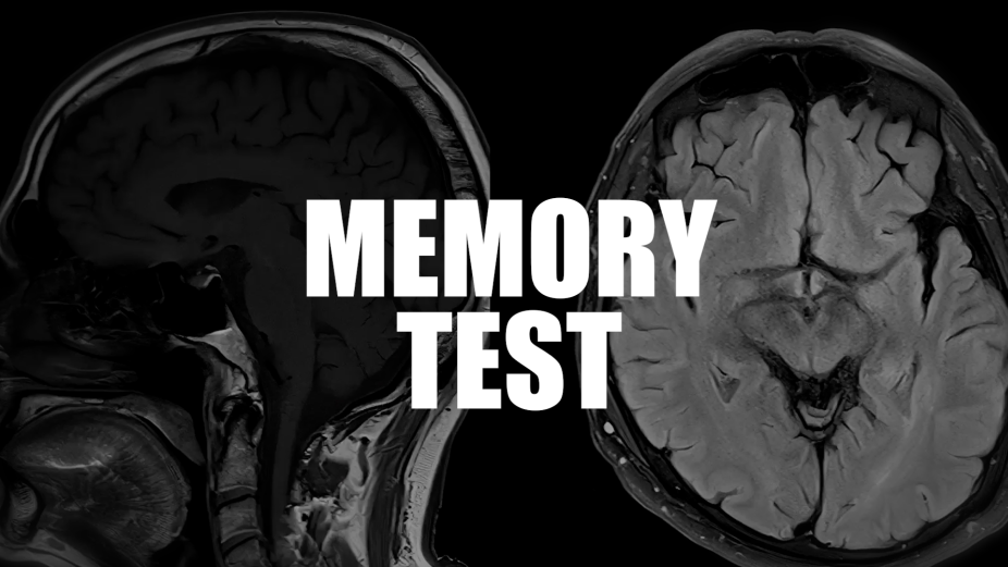 Supradyn Surprises the Internet through a Memory Test with a Twist