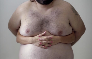 This Pair of Man Boobs will Teach You How to Spot Breast Cancer
