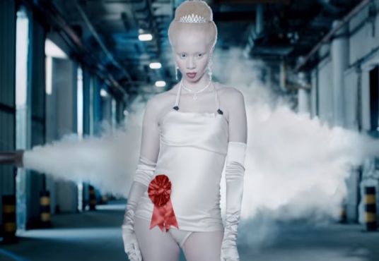 Albino Model, Actress, Lawyer and Activist Challenges Stereotypes for Audi
